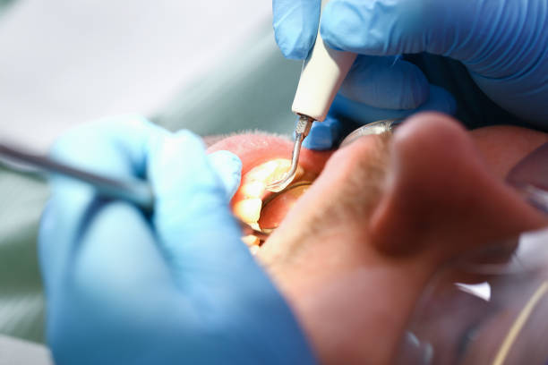 Best Mobile Emergency Dentist in Worthgton, IN